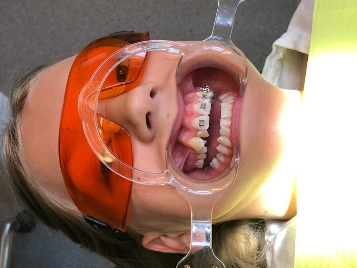 Olivia hos tandläkaren